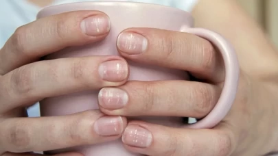 Tırnaklardaki beyaz çizgilerin sebebi ne?