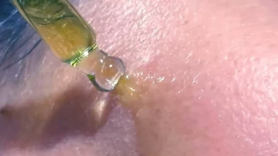 Menopoz döneminde elastikiyet kaybına karşı cilt bakım rehberi