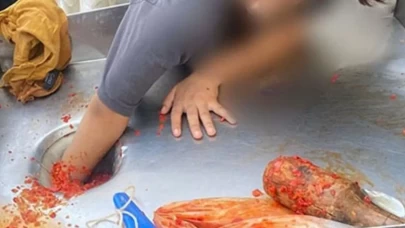 Şanlıurfa’da feci olay! Salça makinesine elini kaptırmıştı