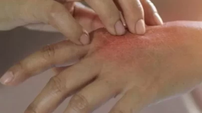 İlaç değil, İbn-i Sina dokunuşu!