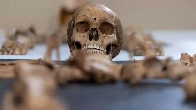 Avustralya'da bir üniversitenin 25 yıl boyunca izinsiz beden parçaları topladığı belirlendi