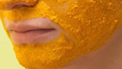 Kızarıklıkları azaltıyor, lekeleri hafifletiyor