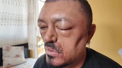 Siyah saç şampuanı kör ediyordu