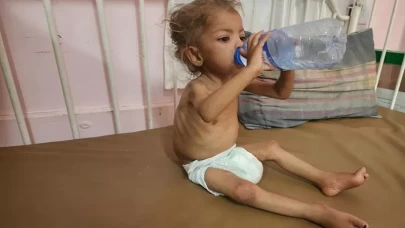 Gazze'de açlıktan ölüyor!