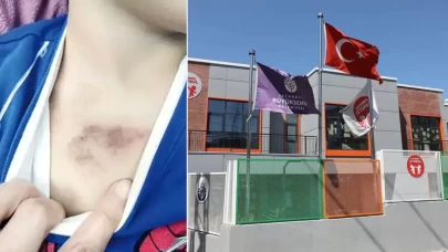 İBB kreşinde darp ve istismar!