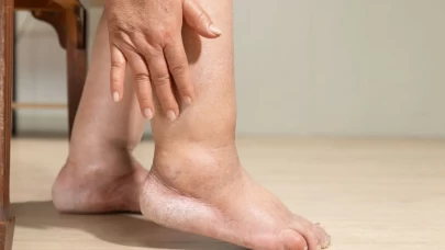 Vücudun su tutmasının arkasındaki gerçekler