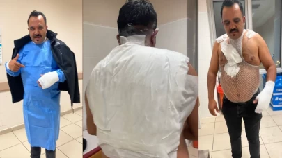 Tost ile meşhur olan esnaf, etkileşim uğruna şov yapayım derken kendini yaktı!