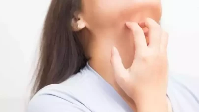 Boyun kaşıntısı nasıl geçer?