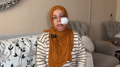 Elektrikli bisikletli kadının rögar dehşeti: Yüzüne 14 dikiş atıldı