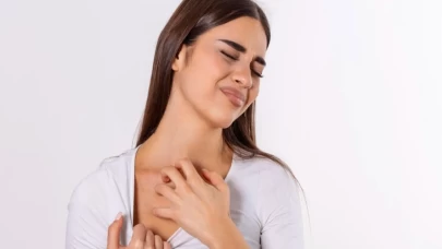 Uyuz eşyalardan bulaşır mı?