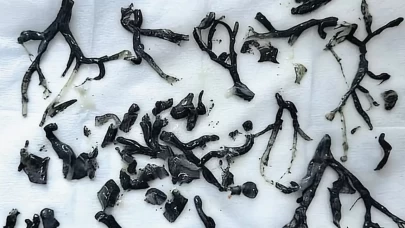 Nefes darlığıyla hastaneye gitti