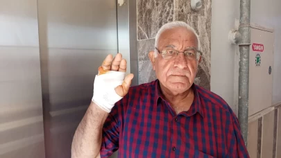 Asansörde yamyamlık! Komşusu parmağını ısırarak kopardı