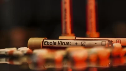 Ebola salgını KDC'de 1 milyon kişiyi daha yoksulluğa sürükleyebilir