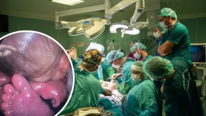 Anne karnındaki bebeğe kapalı yöntemle omurilik ameliyatı yapıldı