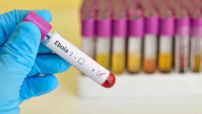 DSÖ’den Kongo için Ebola alarmı
