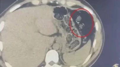 Diyarbakır'da midelerinde 1 kiloya yakın metamfetamin taşıyan 2 şüpheli tutuklandı