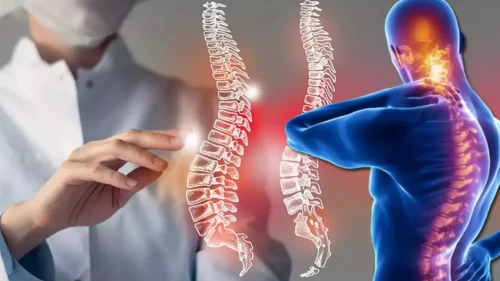 Ankilozan spondilit nedir?