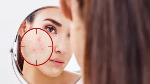 Uzmanlar o hataya dikkat çekti