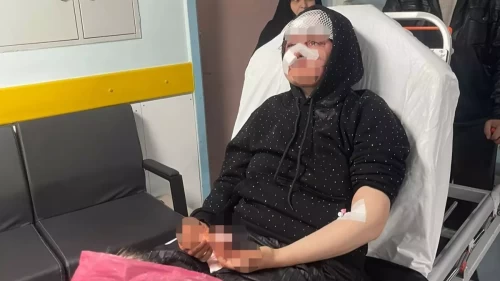 Boşanma davası öncesi dehşet