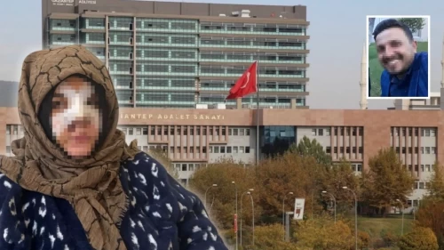 Güzelliğine güveniyorsun, onu elinden alacağım!