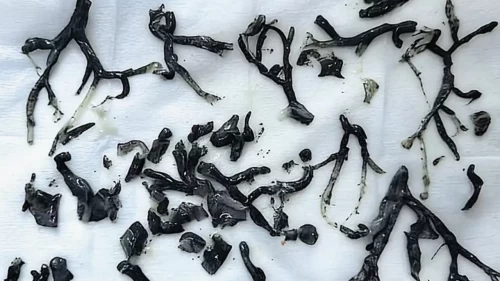 Nefes darlığıyla hastaneye gitti