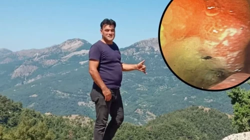 Yaylada uyurken yaşadığı olay tıbbi literatüre girdi!