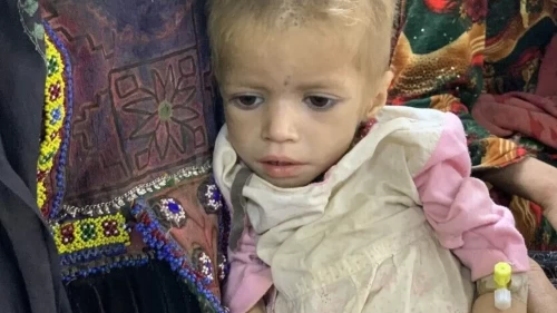 Afganistan'da 3,7 milyon çocuk yetersiz beslendiği için acı çekiyor