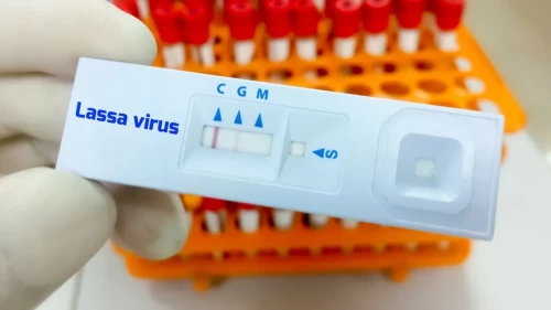Lassa ateşi Nijerya'da 225 can aldı!