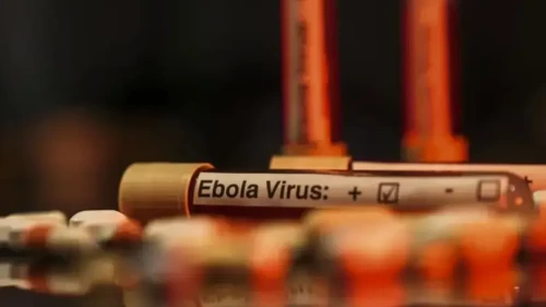 Nijerya'da ilk Ebola virüsü vakası tespit edildi