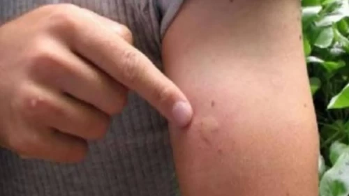 Uzman isim uyardı: Batı Nil virüsü Türkiye’de de görülebilir