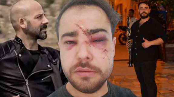 Bir Onur Şener vakası daha! Yusufcan Karagündüz’ü istek parça yüzünden öldüresiye dövdüler