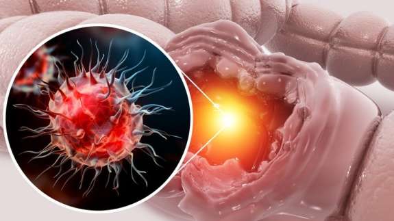 Kahveye 1 kaşık eklemek yetiyor! Karaciğeri baştan sona yeniliyor...