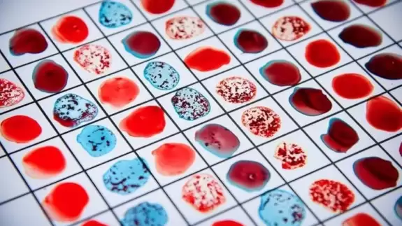 Bu kan grubuna sahip olanlar dikkat!