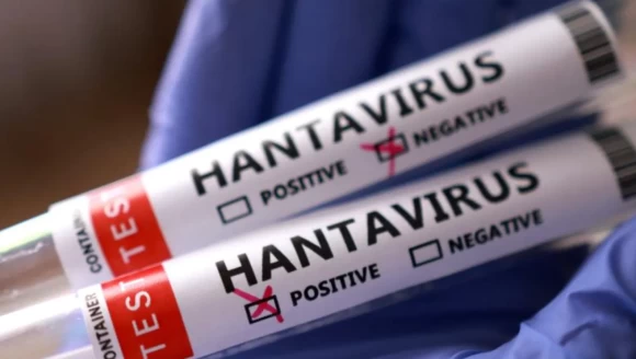 İsrail'de hantavirüs alarmı