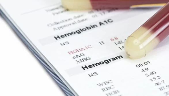 Bu 4 kan değerini dengeleyin