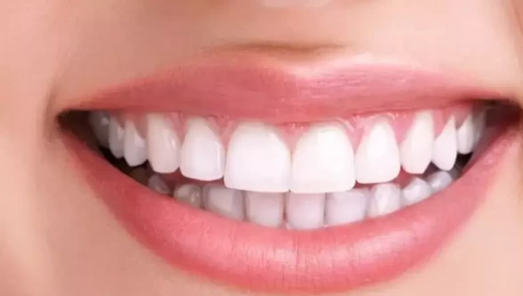 Doğal gülüşün şifresi çözüldü! Evde diş beyazlatmanın altın kuralları