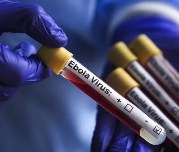 İsrail’de ilk kez Ebola alarmı! Aşısı ve tedavisi olmayan varyant kapıda!
