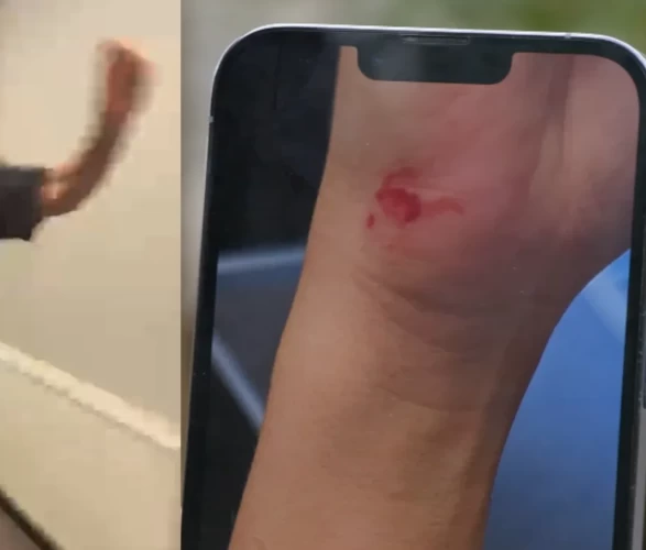 Eyüpsultan'da kadın eğitmene kira zammı dayağı