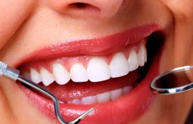 Diş taşlarını doğal yolla yok ediyor