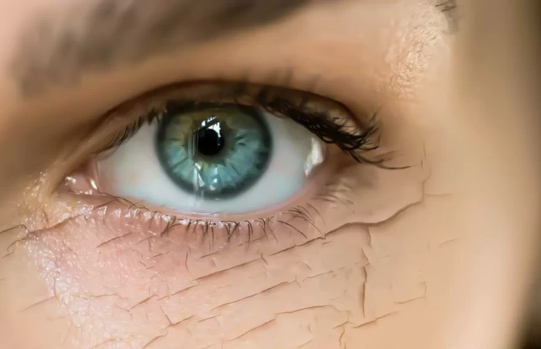 Göz kuruluğunun gerçek nedeni  bakın neymiş