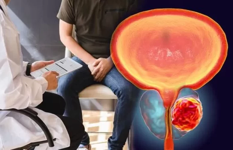 Prostat kanserinde erken tanı için uzmanlardan uyarı