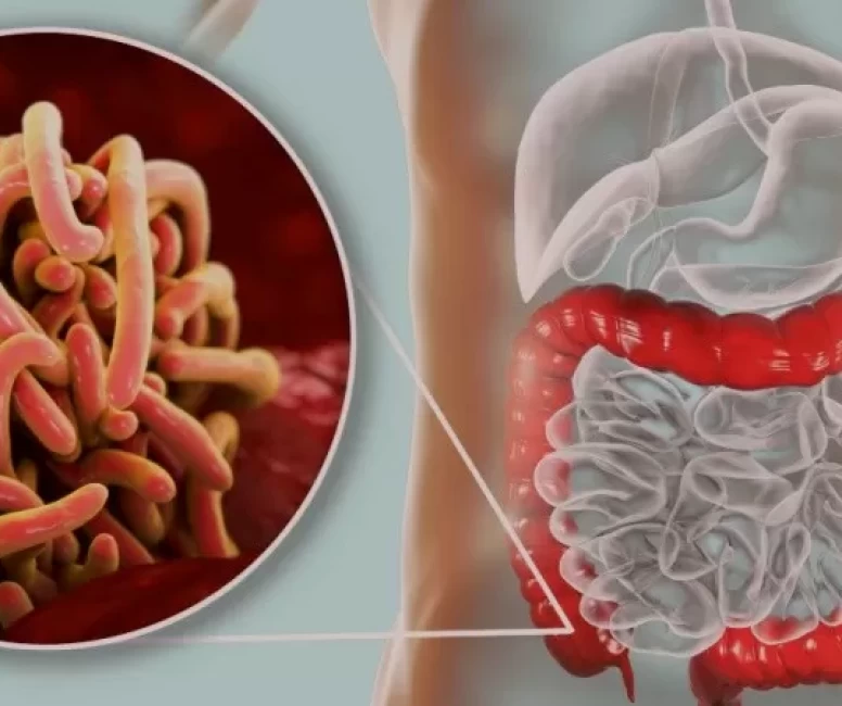 Hamilelikte Kıl Kurdu: Bebeğe Risk Oluşturur mu?