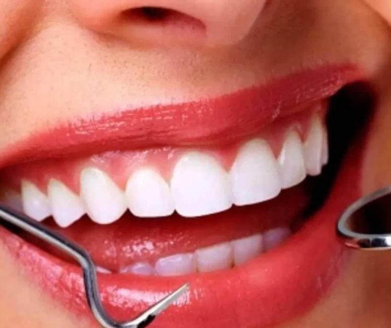 Diş taşlarını doğal yolla yok ediyor