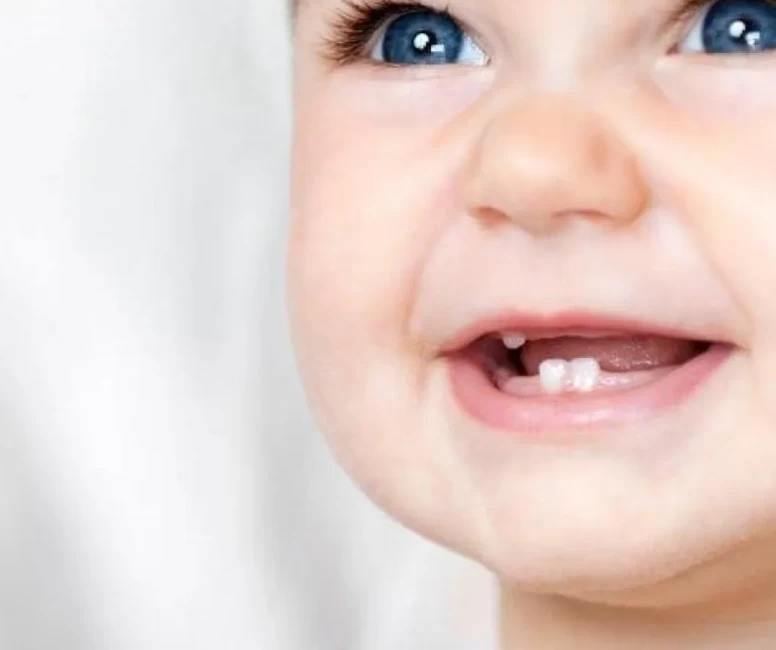 Hamilelik stresi ile erken süt dişi arasındaki çarpıcı bağlantı