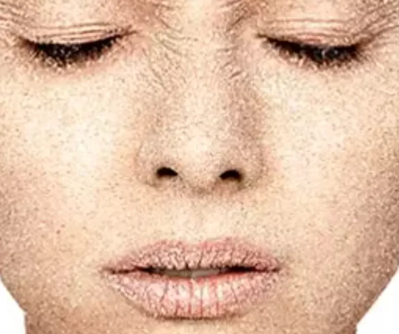 Gölge noktası yağ eksikliği dikkat çekti!