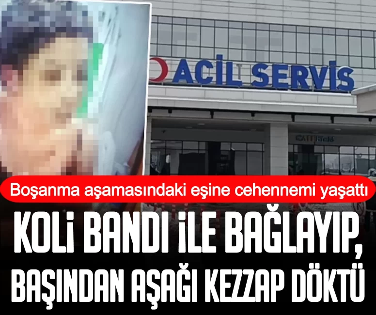 Boşanma aşamasındaki eşine cehennemi yaşattı: Koli bandı ile bağlayıp, başından aşağı kezzap döktü