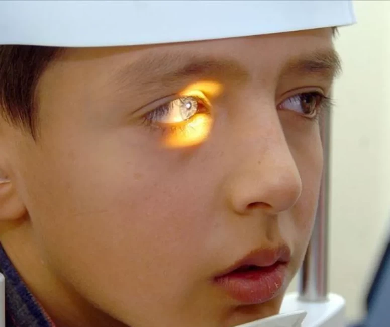 Okula giden çocuklarda "Göz Nezlesi" alarmı! Anne-Babalar bu belirtilere dikkat