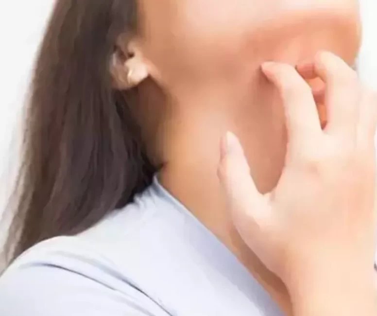 Boyun kaşıntısı nasıl geçer?