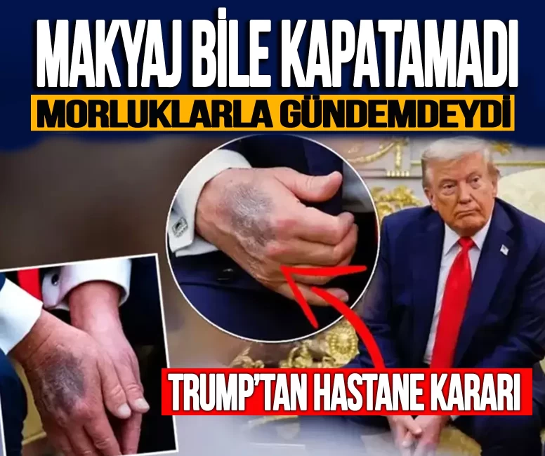 Vücudundaki morluklar gündemdeydi! Trump'tan hastane kararı