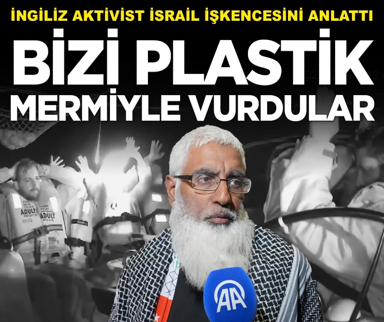 'Bizi plastik mermiyle vurdular'